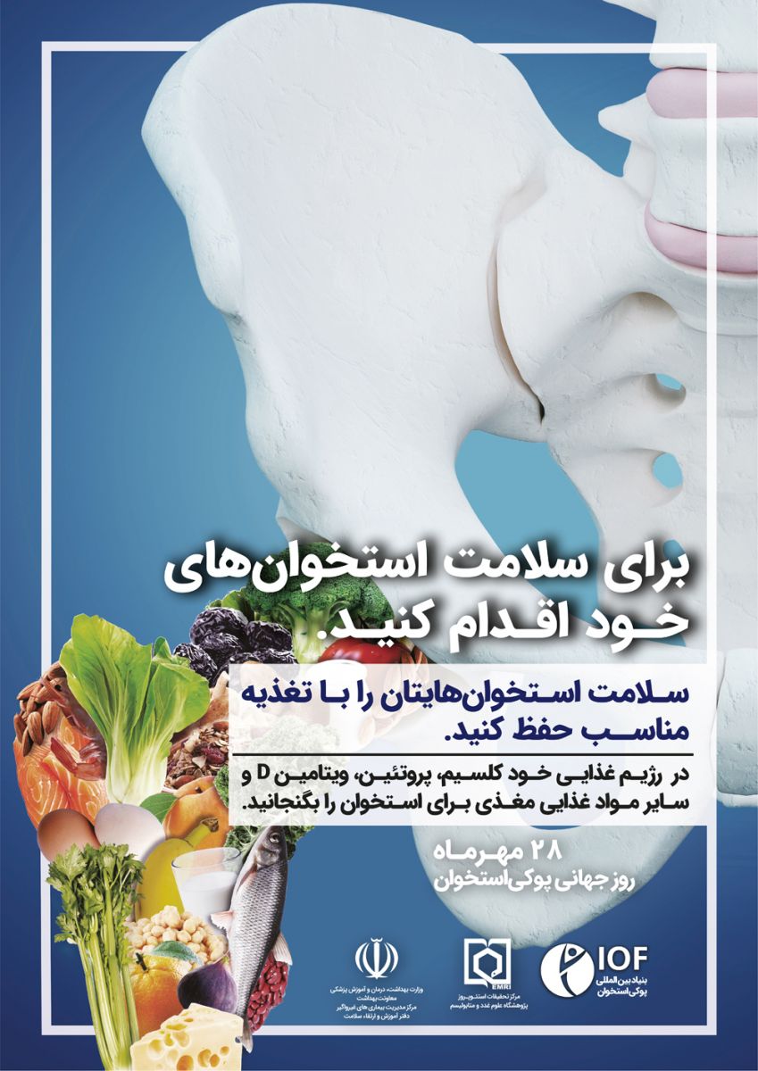 20 اكتبر (28 مهرماه) روز جهاني پوكي استخوان